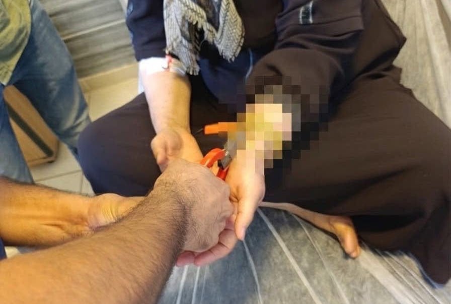 Besni’de kadının bileğine sıkışan altın itfaiye tarafından çıkartıldı